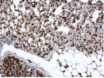 Immunohistochemistry-Paraffin: COMMD7 Antibody [NBP1-31697] - Sample: Paraffin-embedded mouse lung. COMMD7 antibody diluted at 1:500.