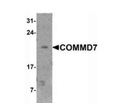 Western Blot COMMD7 Antibody - BSA Free