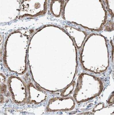 Immunohistochemistry-Paraffin COMMD8 Antibody - BSA Free