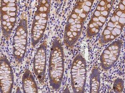 Immunohistochemistry-Paraffin: COMMD9 Antibody (002) [NBP2-90291] - Staining of human COMMD9 in human small intestine with rabbit monoclonal antibody (1:5000).