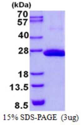 SDS-PAGE Recombinant Human COMMD9 His Protein