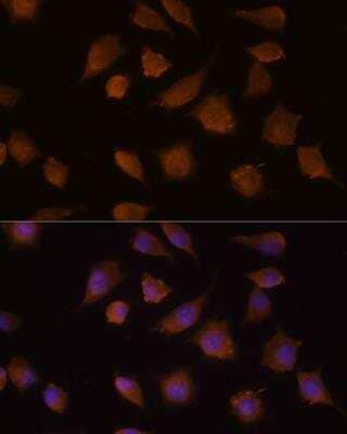 Immunocytochemistry/Immunofluorescence: COMP/Thrombospondin-5 Antibody [NBP2-92733] - Analysis of L929 cells using COMP Rabbit pAb at dilution of 1:100 (40x lens). Blue: DAPI for nuclear staining.