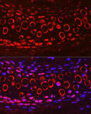 Immunohistochemistry: COMP/Thrombospondin-5 Antibody [NBP2-92658] - Immunofluorescence analysis of Mouse cartilage using COMP/Thrombospondin-5 Rabbit pAb (NBP2-92658) at dilution of 1:200 (40x lens). Blue: DAPI for nuclear staining.