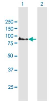 Western Blot: COMP/Thrombospondin-5 Antibody [H00001311-B01P] - Analysis of COMP expression in transfected 293T cell line by COMP polyclonal antibody.  Lane 1: COMP transfected lysate(79.64 KDa). Lane 2: Non-transfected lysate.