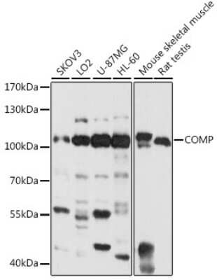 Western Blot: COMP/Thrombospondin-5 Antibody [NBP2-92733] - Analysis of extracts of various cell lines, using COMP/Thrombospondin-5 at 1:1000 dilution.Secondary antibody: HRP Goat Anti-Rabbit IgG (H+L) at 1:10000 dilution.Lysates/proteins: 25ug per lane.Blocking buffer: 3% nonfat dry milk in TBST.Detection: ECL Basic Kit .Exposure time: 1s.