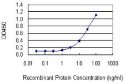 Sandwich ELISA: COMT Antibody (1G4-1A1) [H00001312-M01] - Detection limit for recombinant GST tagged COMT is 0.3 ng/ml as a capture antibody.