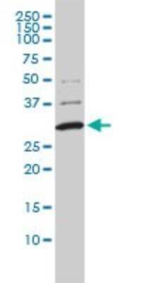 Western Blot: COMT Antibody (1G4-1A1) [H00001312-M01] - COMT monoclonal antibody (M01), clone 1G4-1A1 Analysis of COMT expression in A-431.