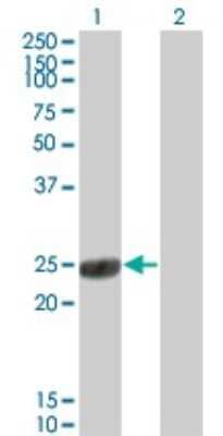 Western Blot: COMT Antibody (1G4-1A1) [H00001312-M01] - Analysis of COMT expression in transfected 293T cell line by COMT monoclonal antibody (M01), clone 1G4-1A1.Lane 1: COMT transfected lysate(24.4 KDa).Lane 2: Non-transfected lysate.