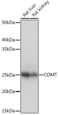 Western Blot: COMT Antibody (9Y2A3) [NBP3-16413] - Western blot analysis of extracts of various cell lines, using COMT Rabbit mAb (NBP3-16413) at 1:1000 dilution. Secondary antibody: HRP Goat Anti-Rabbit IgG (H+L) at 1:10000 dilution. Lysates/proteins: 25ug per lane. Blocking buffer: 3% nonfat dry milk in TBST. Detection: ECL Basic Kit. Exposure time: 1s.