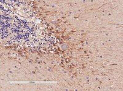 Immunohistochemistry-Paraffin: COMT Antibody [NB100-41387] - Staining of paraffin embedded Human Cerebellum. Antibody at 4 ug/mL. Microwaved antigen retrieval with Tris/EDTA buffer pH 9, HRP-staining.