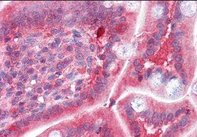 Immunohistochemistry-Paraffin: COMT Antibody [NB100-41387] - Staining of paraffin embedded Human Small Intestine. Steamed antigen retrieval with citrate buffer pH 6, AP-staining. Antibody at 3.75 ug/mL.