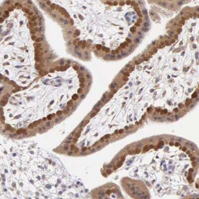 Immunohistochemistry-Paraffin: COMT Antibody [NBP1-85818] - Staining of human placenta shows moderate cytoplasmic positivity in trophoblastic cells.