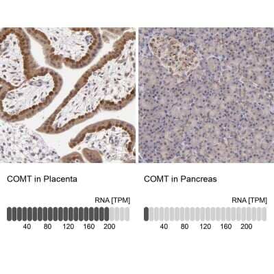 <b>Orthogonal Strategies Validation. </b>Immunohistochemistry-Paraffin: COMT Antibody [NBP1-85818] - Staining in human placenta and pancreas tissues using anti-COMT antibody. Corresponding COMT RNA-seq data are presented for the same tissues.