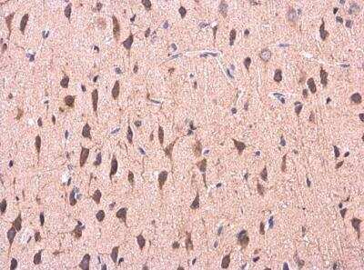 Immunohistochemistry-Paraffin: COMT Antibody [NBP2-15954] - Paraffin-embedded Rat brain. COMT antibody diluted at 1:500.