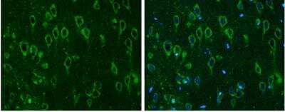 <b>Genetic Strategies Validation. </b>Immunohistochemistry-Paraffin: COMT Antibody [NBP2-15954] - Paraffin-embedded rat brain. COMT antibody diluted at 1:500.