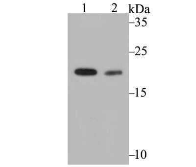 Western Blot: COMT Antibody (JG39-48) [NBP2-75444] - Analysis of COMT on MCF-7 cell (1) and rat testis tissue (2) lysate using anti-COMT antibody at 1/2,000 dilution.