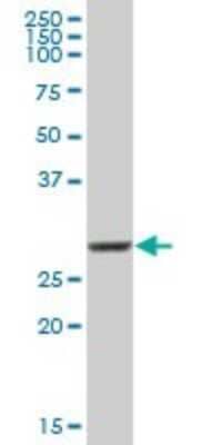 Western Blot: COMT Antibody [H00001312-B01P] - Analysis of COMT expression in human placenta.