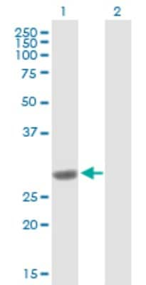 Western Blot: COMT Antibody [H00001312-B01P] - Analysis of COMT expression in transfected 293T cell line by COMT polyclonal antibody.  Lane 1: COMT transfected lysate(24.31 KDa). Lane 2: Non-transfected lysate.