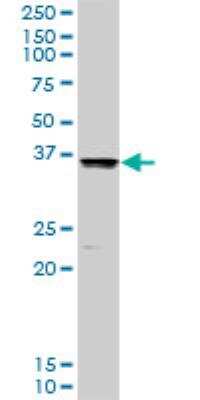 Western Blot: COMT Antibody [H00001312-D01P] - Analysis of COMT expression in mouse liver.