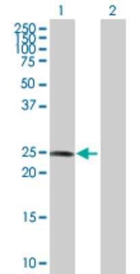 Western Blot: COMT Antibody [H00001312-D01P] - Analysis of COMT expression in transfected 293T cell line by COMT polyclonal antibody.Lane 1: COMT transfected lysate(24.40 KDa).Lane 2: Non-transfected lysate.