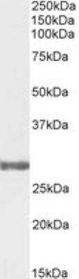 Western Blot: COMT Antibody [NB100-41387] - Staining of Human Testis lysate (35 ug protein in RIPA buffer). Antibody at 0.3 ug/mL. Primary incubation was 1 hour. Detected by chemiluminescence.