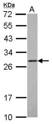 Western Blot: COMT Antibody [NBP2-15954] - COMT antibody detects COMT protein by Western blot analysis. A. 30 ug K562 whole cell lysate/extract 12 % SDS-PAGECOMT antibody dilution: 1:1000.