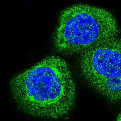 Immunocytochemistry/Immunofluorescence: COMTD1 Antibody [NBP1-82065] - Immunofluorescent staining of human cell line A-431 shows localization to plasma membrane, cytosol & the Golgi apparatus.