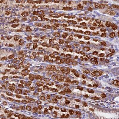 Immunohistochemistry-Paraffin: COMTD1 Antibody [NBP1-82065] - Staining of human stomach, lower shows strong cytoplasmic positivity in glandular cells.