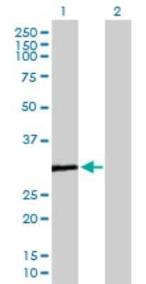 Western Blot: COMTD1 Antibody [H00118881-B01P] - Analysis of COMTD1 expression in transfected 293T cell line by COMTD1 polyclonal antibody.  Lane 1: COMTD1 transfected lysate(28.82 KDa). Lane 2: Non-transfected lysate.
