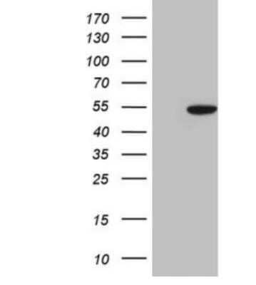 Western Blot: COP9 Antibody (OTI3E1) - Azide and BSA Free [NBP2-71382] - HEK293T cells were transfected with the pCMV6-ENTRY control (Left lane) or pCMV6-ENTRY COPS3 (Right lane) cDNA for 48 hrs and lysed. Equivalent amounts of cell lysates (5 ug per lane) were separated by SDS-PAGE and immunoblotted with antiCOPS3.(1:2000