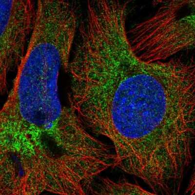 Immunocytochemistry/Immunofluorescence: COPB2 Antibody [NBP2-54952] - Staining of human cell line U-2 OS shows localization to cytosol.