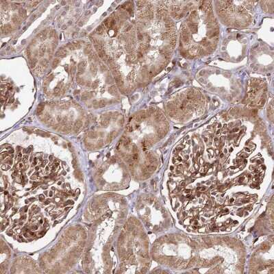 Immunohistochemistry-Paraffin: COPG Antibody [NBP1-85514] - Staining of human kidney shows strong cytoplasmic positivity in cells in tubules.