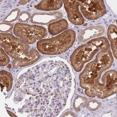 Immunohistochemistry-Paraffin: COPG Antibody [NBP2-58317] - Immunohistochemical staining of human kidney shows strong cytoplasmic positivity in cells in tubules.