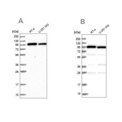 <b>Independent Antibodies Validation. </b>Western Blot: COPG Antibody [NBP1-85514] - Analysis using Anti-COPG1 antibody NBP1-85514 (A) shows similar pattern to independent antibody NBP2-55178 (B).