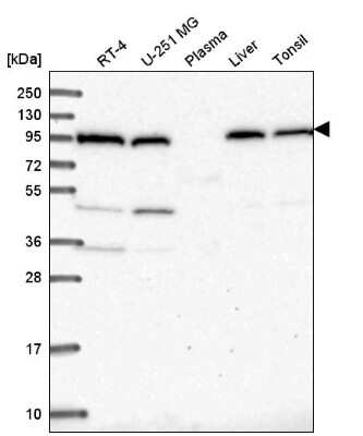 Western Blot COPG Antibody