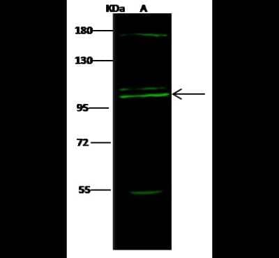 Western Blot: COPG Antibody [NBP2-99186] - Anti-COPG1 rabbit polyclonal antibody at 1:500 dilution. Lane A: THP1 Whole Cell Lysate Lysates/proteins at 30 ug per lane. Secondary Goat Anti- Rabbit IgG H&L (Dylight 800) at 1/10000 dilution. Developed using the Odyssey technique. Performed under reducing conditions. Predicted band size: 105 kDa. Observed band size: 105 kDa (We are unsure as to the identity of these extra bands).