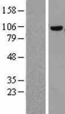 Western Blot COPG Overexpression Lysate