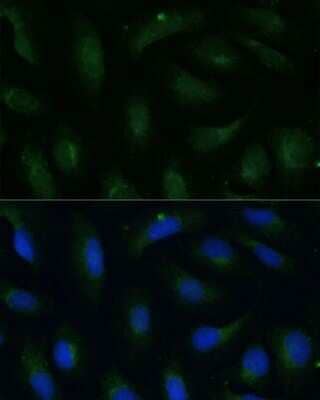 Immunocytochemistry/Immunofluorescence: COPG2 Antibody [NBP2-92869] - Analysis of U-2 OS cells using COPG2 . Blue: DAPI for nuclear staining.