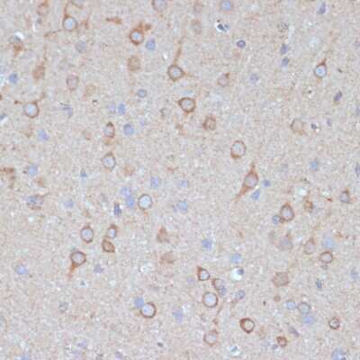 Immunohistochemistry-Paraffin: COPG2 Antibody [NBP2-92868] - Rat brain using COPG2 antibody at dilution of 1:100 (40x lens).