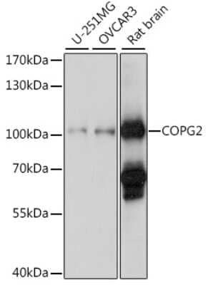 Western Blot: COPG2 Antibody [NBP2-92868] - Analysis of extracts of various cell lines, using COPG2 at 1:1000 dilution.Secondary antibody: HRP Goat Anti-Rabbit IgG (H+L) at 1:10000 dilution.Lysates/proteins: 25ug per lane.Blocking buffer: 3% nonfat dry milk in TBST.Detection: ECL Basic Kit .Exposure time: 90s.