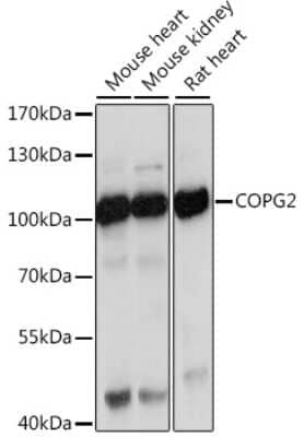 Western Blot: COPG2 Antibody [NBP2-92869] - Analysis of extracts of various cell lines, using COPG2 at 1:1000 dilution.Secondary antibody: HRP Goat Anti-Rabbit IgG (H+L) at 1:10000 dilution.Lysates/proteins: 25ug per lane.Blocking buffer: 3% nonfat dry milk in TBST.Detection: ECL Basic Kit .Exposure time: 30s.