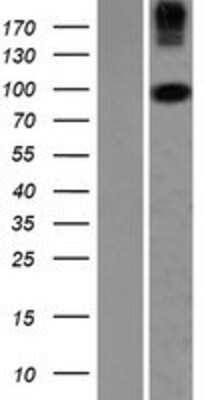 Western Blot COPG2 Overexpression Lysate