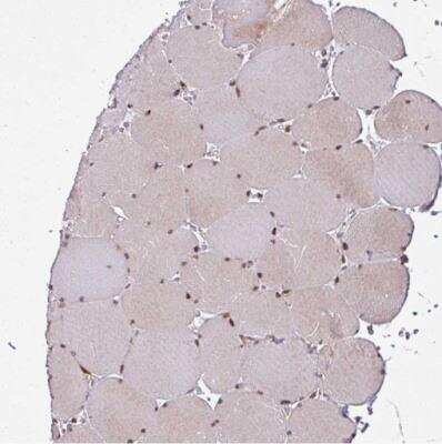 Immunohistochemistry-Paraffin COPR5 Antibody