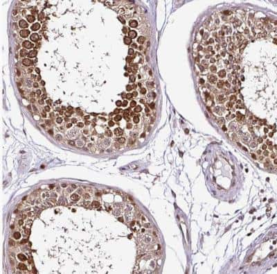 Immunohistochemistry-Paraffin: COPR5 Antibody [NBP2-30884] - Staining of human testis shows strong nuclear positivity in cells in seminiferous ducts.