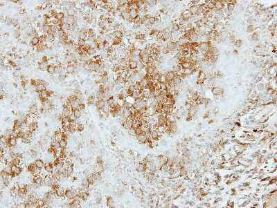 Immunohistochemistry-Paraffin: COPS4 Antibody [NBP2-15961] - Immunohistochemical analysis of paraffin-embedded J5 xenograft, using antibody at 1:500 dilution.