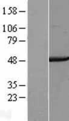 Western Blot: COPS4 Overexpression Lysate (Adult Normal) [NBL1-09382] Left-Empty vector transfected control cell lysate (HEK293 cell lysate); Right -Over-expression Lysate for COPS4.