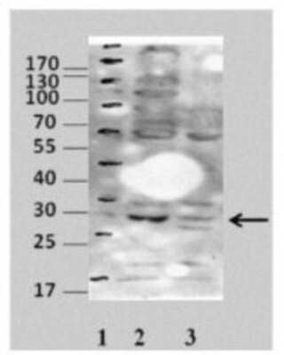 Western Blot: COPS7A Antibody [NBP1-53118] - Sample Type: 1. Markers 2. B8 mouse fibroblast cells, extraction only 3. Human total cells, pure Primary Dilution: 1:500 Secondary antibody: HRP conjugated anti-rabbit Image Submitted By: Dr. Elah Pick University of Haifa at Oranim