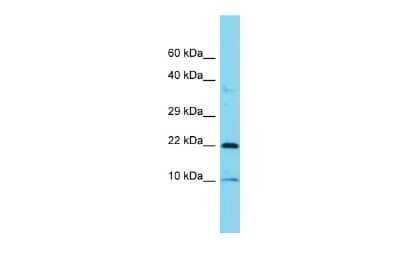 Western Blot: COPZ1 Antibody [NBP3-10764] - Western blot analysis of COPZ1 in Placenta lysates. Antibody dilution at 1.0ug/ml