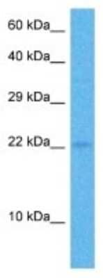 Western Blot: COPZ1 Antibody [NBP3-10793] - Western blot analysis of COPZ1 in Human Breast Tumor lysates. Antibody dilution at 1ug/ml