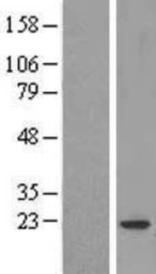 Western Blot: COPZ1 Overexpression Lysate (Adult Normal) [NBL1-09387] Left-Empty vector transfected control cell lysate (HEK293 cell lysate); Right -Over-expression Lysate for COPZ1.